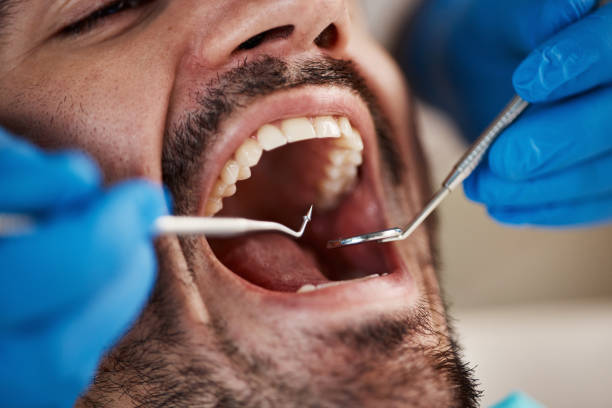 Best Emergency Dental Surgery in Homeland, GA